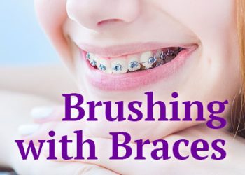 Calgary Alberta dentist, Dr. Crawford of Calgary Dental House informs patients about the best tools and tricks to use when performing oral hygiene routines with braces.