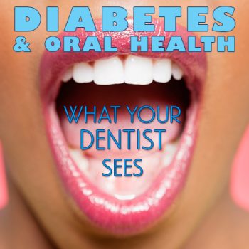 Calgary, Alberta dentist, Dr. Crawford of Calgary Dental House, discusses the side effects of diabetes and how it can affect your oral health.