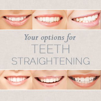 Calgary, Alberta dentist, Dr. Crawford at Calgary Dental House shares all you need to know about choosing the right teeth straightening option for you.