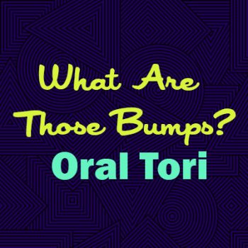 Calgary, Alberta dentist, Dr. Crawford of Calgary Dental House, explains oral tori—what they are, why they happen, and whether they are a cause for concern.