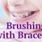 Brushing with Braces: Cleaning Every Nook & Cranny (featured image)